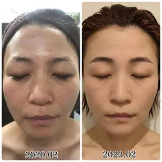 渡邊 直子のネイルデザイン