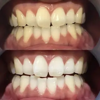 bright所属・eyelash brightのマツエク・マツパデザイン