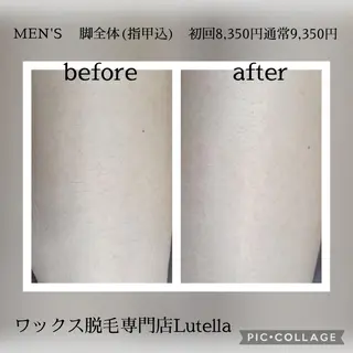 メンズ Lutella所属・ワックス脱毛専門店 Lutellaのエステ・リラクイメージ