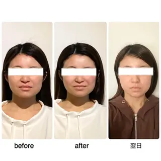 セミロング ヘアアレンジ ネイル 小顔矯正専門サロンジュマリ所属・町田 淳子のエステ・リラクイメージ