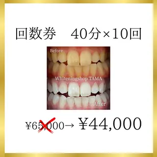 メンズ キッズ ホワイトニング ショップ多摩店のその他イメージ