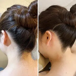 うなじ脱毛/美肌脱毛 LABELのエステ・リラクイメージ