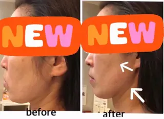 アクシア ビューティー サロン所属・究極のアンチエイ ジングサロンのエステ・リラクイメージ