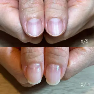 ネイル 埼玉県ちび爪専門店｜ 自爪育成｜朝霞市のネイルデザイン