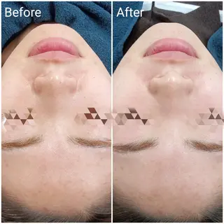 肌質改善Beauty salon Renのエステ・リラクイメージ