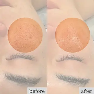DahliaBeauty ダリアビューティー所属・春日井市Dahlia Beauty　中村のエステ・リラクイメージ