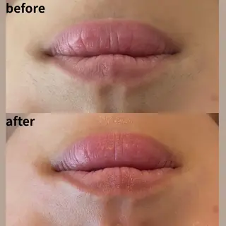 salon more所属・村山 奈実のエステ・リラクイメージ