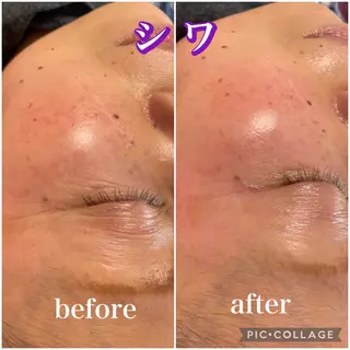 毛穴レス ハーブ& ワックス脱毛×光脱毛のエステ・リラクイメージ