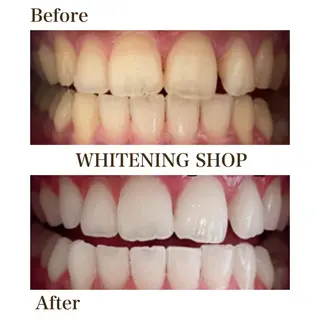 メンズ ホワイトニング ショップ川越店のエステ・リラクイメージ