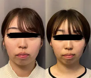 医療提携×美容整体 小顔ハイフピーリングのエステ・リラクイメージ