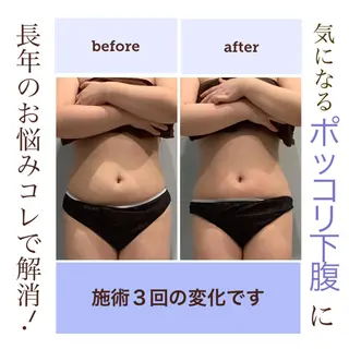 エステサロン JURISのエステ・リラクイメージ