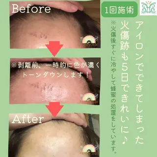 剥離するハーブ🌈 Honey Sideのエステ・リラクイメージ