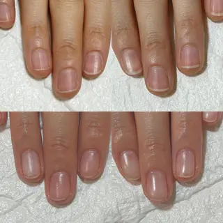 ネイル 自爪育成・巻き爪 補正講師　津蔵のネイルデザイン