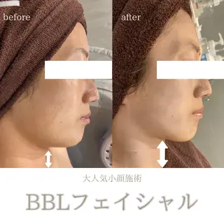 DahliaBeauty ダリアビューティー所属・DahliaBeau tyフェイシャル中村のその他イメージ