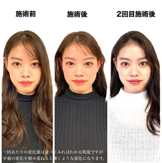 小顔・美肌専門 天六駅徒歩1分のエステ・リラクイメージ
