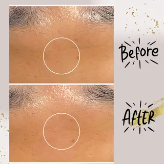 ピーリング専門店 Belluteのエステ・リラクイメージ