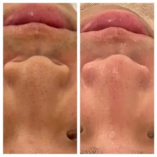 ANERA Second所属・尾上 沙織のエステ・リラクイメージ