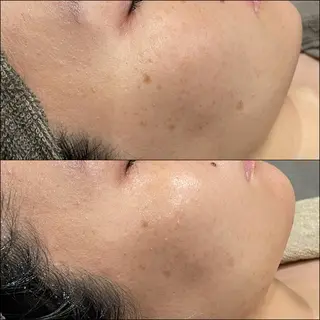 LiZA エステティックサロンのエステ・リラクイメージ