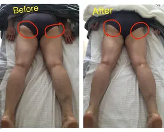 子宮矯正/腸揉み/ シュガーリング脱毛のエステ・リラクイメージ