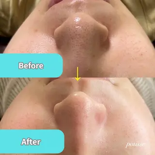 脱毛TWINKLE Shimadaのエステ・リラクイメージ