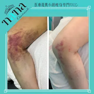 小顔痩身インディバ Nana表参道のエステ・リラクイメージ