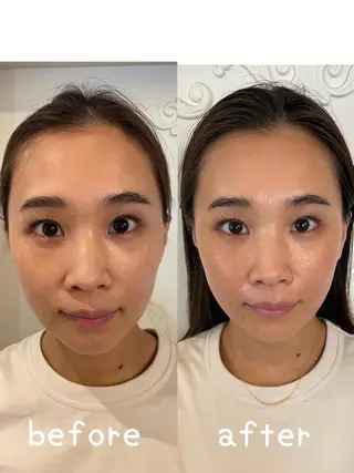 美容鍼灸サロン mahoroba院長のエステ・リラクイメージ