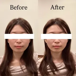 Hari Lounge恵比寿所属・chika🦋 ハリラウンジ恵比寿のエステ・リラクイメージ