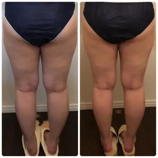 FLEUR大阪・美容 整体・痩身・小顔のエステ・リラクイメージ