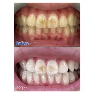 MBEAUTYSALON 千葉店・京成大久保所属・Melty 輝のその他イメージ