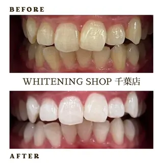 メンズ ホワイトニング ショップ千葉店のその他イメージ