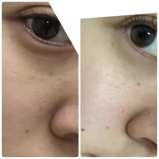 KIRICO まつぱマツエク眉毛のマツエク・マツパデザイン