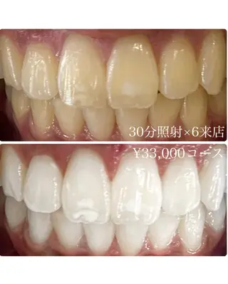メンズ ホワイトニングルーム 川崎店所属・ホワイトニング ルーム 川崎店のその他イメージ