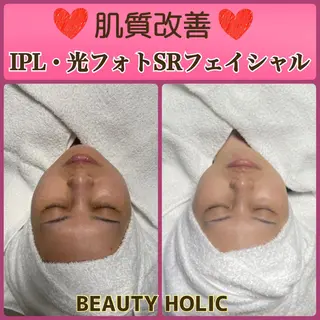 ニキビ・ 肌荒れ専門店のエステ・リラクイメージ