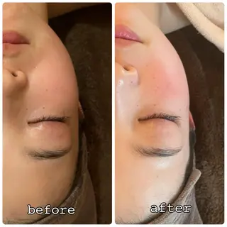 Luce所属・Luce Shokoのエステ・リラクイメージ