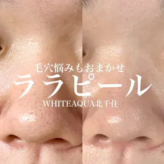 WHITE AQUA 北千住店のエステ・リラクイメージ