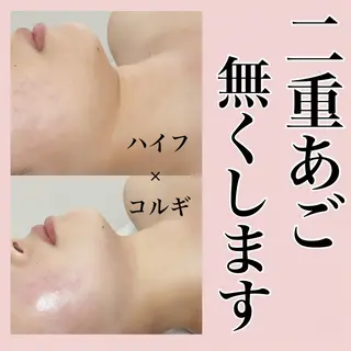 ■超絶小顔＆肌管理室■所属・🦋整形級の究極美顔 本格韓国式小顔🦋のエステ・リラクイメージ