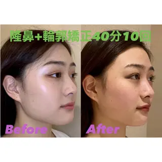 隆鼻矯正専門店ラプリ 佐藤のエステ・リラクイメージ