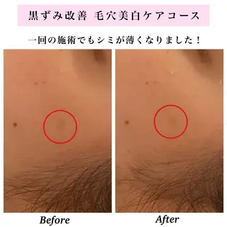 Bellesthe (ベルエステ)のエステ・リラクイメージ