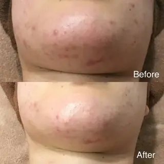 メンズ ネイル マツエク・マツパ エステ.まつげ.小顔 眉毛.プラズマ.脱毛のマツエク・マツパデザイン