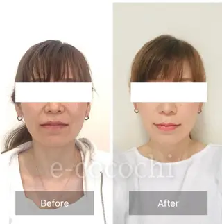 小顔と ヘッドスパのお店のエステ・リラクイメージ