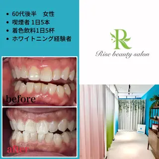 Rise　beauty salon所属・RISE beaut y salonのエステ・リラクイメージ
