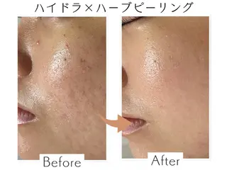 プライベートサロン Belle(ベル)のエステ・リラクイメージ