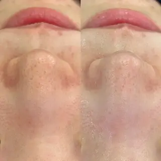 Venus所属・エステサロン Venusのエステ・リラクイメージ