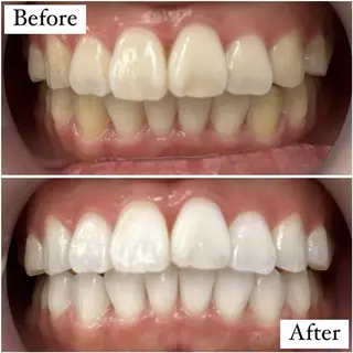 LBSホワイトニング 銀座店💎スタッフ峯のその他イメージ