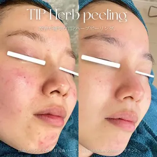 Mau beauty salon所属・Mau (マウ)のエステ・リラクイメージ