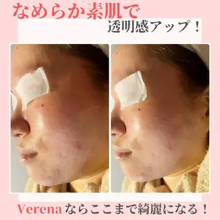 ピーリング専門店 Belluteのエステ・リラクイメージ