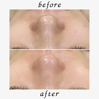 フェイシャル/脱毛 ジョアアンジェ　田中のエステ・リラクイメージ