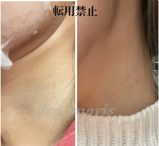private salon Dea_maris シュガーリング&パーソナルボディケア所属・シミ改善・韓国肌管理 ボディメイク痩身のその他イメージ