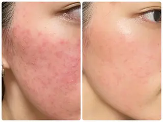 Liberte リベルテ(トモ化粧品店内)所属・RINA 🍒のマツエク・マツパデザイン