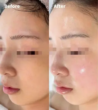 【京都市最安値】 salon YMのエステ・リラクイメージ